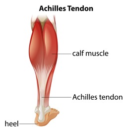 Achilles Tendinopathy Getting on Your Nerves? 1 cbae1d 0b29c8e4ff5747d3841fc995d78cdefc